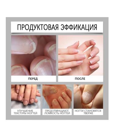 nail repair nutrition Care Oil Improve fragility and dry - Buy Online on GoSupps.com