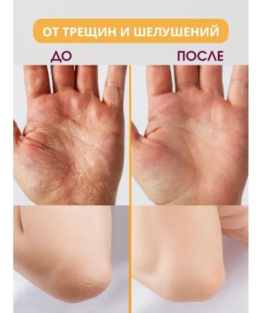 ONDAMARIL Cream-Vosk from cracks Lost Cherry - Buy Online on GoSupps.com