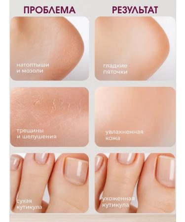 ONDAMARIL Cream-Vosk from cracks Lost Cherry - Buy Online on GoSupps.com