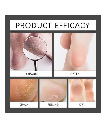 OceAuura moisturizer for foot care cream 100 ml - Buy Online on GoSupps.com