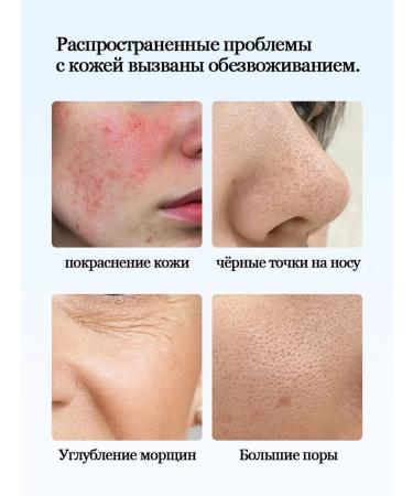 LYDIMOON Moisturizing face mask with niacinamide 10 pcs - Buy Online on GoSupps.com