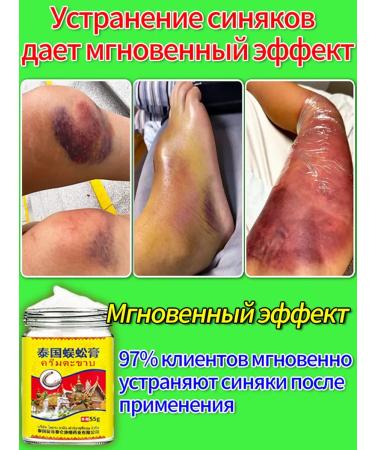 Badyaga from bruises ointment and hematoma 55r
