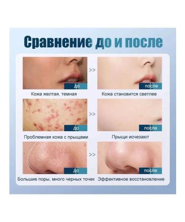 Gel for washing the face from acne and black dots - Buy Online on GoSupps.com