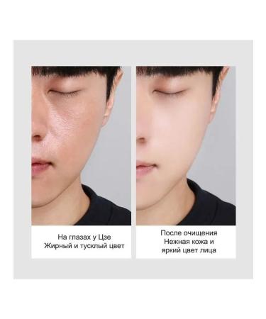 Gel for washing the face from acne and black dots - Buy Online on GoSupps.com
