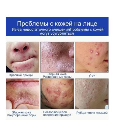 Gel for washing the face from acne and black dots - Buy Online on GoSupps.com