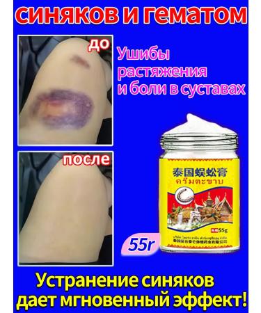 from bruises and hematomas on the body Chinese ointment