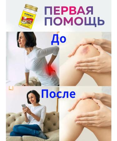 Rescuer ointment from bruises and bruises of stretching - Buy Online on GoSupps.com