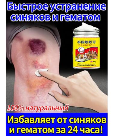 bruise ointment and hematomas on the body 55r