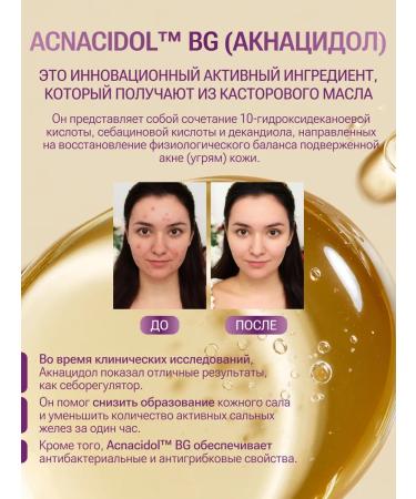 NBR Cosmetics Person's serum against acne and acne 30 ml - Buy Online on GoSupps.com