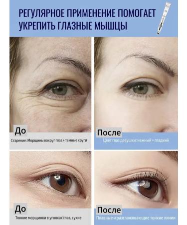 O'CHEAL Eye and skin cream around the eyes are anti -aging with a massager - Buy Online on GoSupps.com
