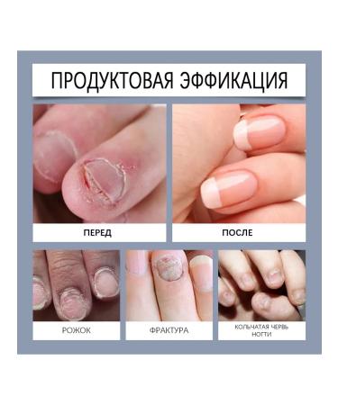 With nails the cerebral care of the sterilizers is cleaned to clean the bacteria - Buy Online on GoSupps.com