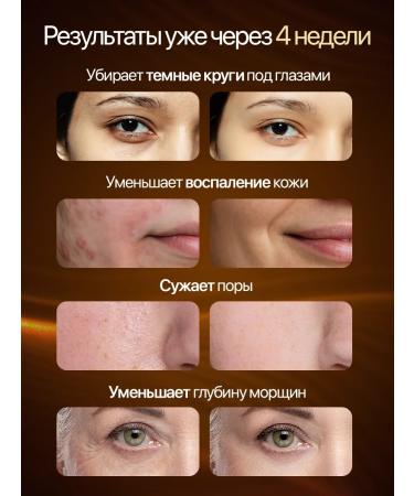 Lieblich House LED face mask LED - Buy Online on GoSupps.com