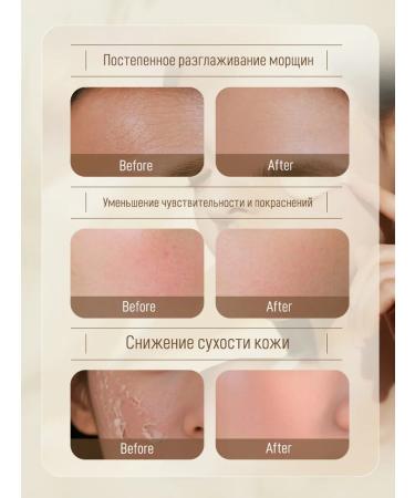 LYDIMOON Nourishing face cream wrinkle removal anti-aging whitening and pigmentation removal - Buy Online on GoSupps.com