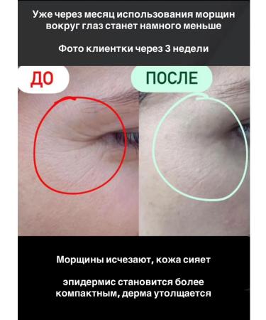 Halal Cosmetics Lifting-cream around the eye deputy-patch effect - Buy Online on GoSupps.com