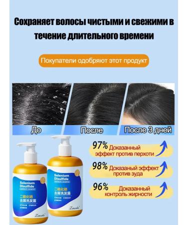 OUTMIX Shampoo against dandruff and itching quickly and effectively 300 ml - Buy Online on GoSupps.com