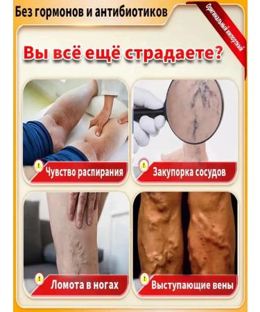 Varifite gel from varicose veins on the legs of Chinese 250g - Buy Online on GoSupps.com