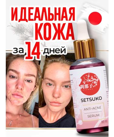 SetSuko Anti-Acne Wedence from acne and black dots with niacinamide and zinc