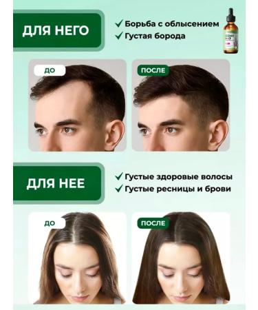 sadoer Rosemary hair oil is indelible for dry split - Buy Online on GoSupps.com