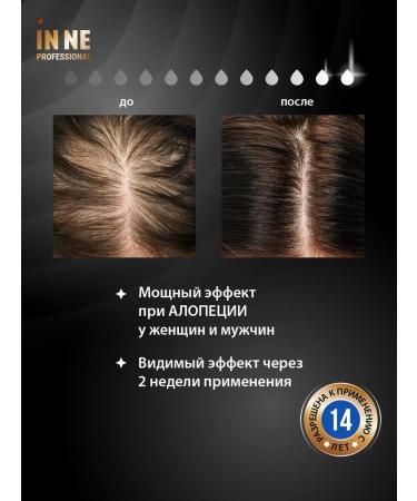 IN NE Hair mask from falling out with peptides 250 ml - Buy Online on GoSupps.com