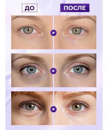 SKINFINITY Anti -aging patches for the eyes with retinol and collagen - Buy Online on GoSupps.com