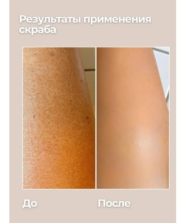 Jensy Body scrub with sea salt Shea Butter+niacinamide - Buy Online on GoSupps.com