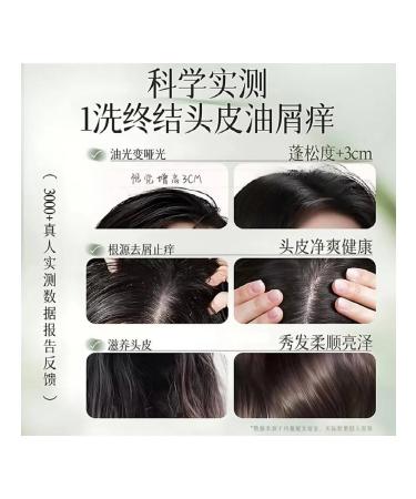 Vlar BEAUTY Shampoo for oily hair and dandruff - Buy Online on GoSupps.com