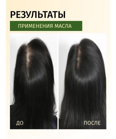Jensy Oil for strengthening and growth of hair with rosemary - Buy Online on GoSupps.com