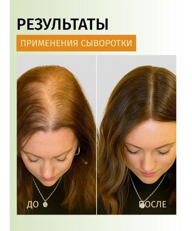 Jensy Serum with rosemary to strengthen and hair growth - Buy Online on GoSupps.com