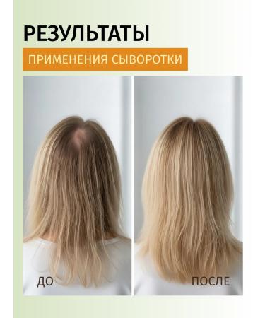 Jensy Serum with rosemary to strengthen and hair growth - Buy Online on GoSupps.com