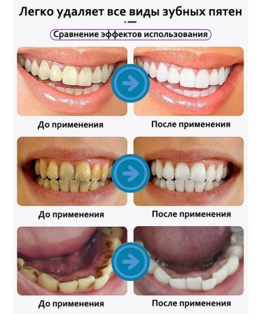 niacinamide toothpaste whitening 100 g - Buy Online on GoSupps.com