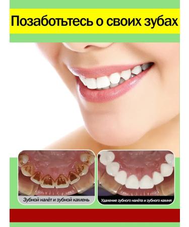 niacinamide toothpaste whitening 100 g - Buy Online on GoSupps.com