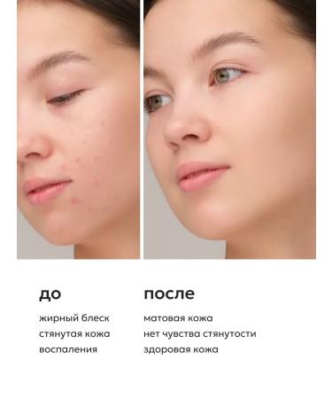 Likato professional Acne post -acne and acne gel 250 ml - Buy Online on GoSupps.com