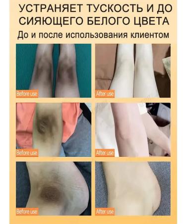 Whitening cream for an intimate zone for armpits 50 g - Buy Online on GoSupps.com