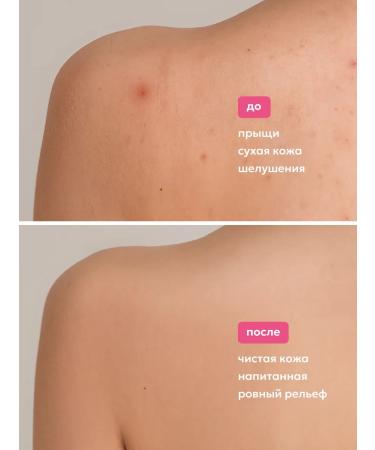 Likato professional A gift from acne on the body - Buy Online on GoSupps.com