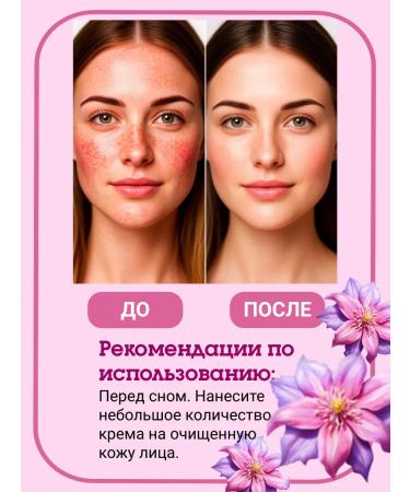 Belita Stop rosacea night cream for redness-prone skin - Buy Online on GoSupps.com