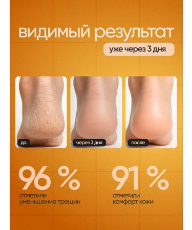 JOMTAM Cream-Vosk from cracks for heels with wax and urea - Buy Online on GoSupps.com