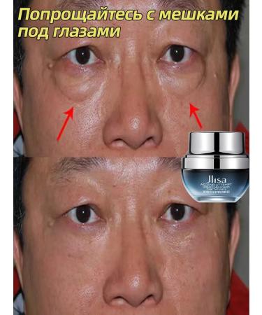 Eye and skin cream around the eyes anti -aging 25 ml