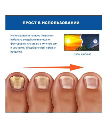 Night forlists for leaving nails from the fungus - Buy Online on GoSupps.com