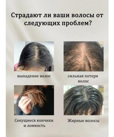 LYDIMOON 5 bottles of essence against hair loss of 50 ml - Buy Online on GoSupps.com