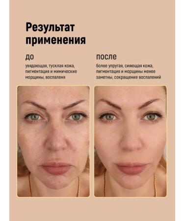 MILOLAB Serum with vitamin C and retinol - Buy Online on GoSupps.com