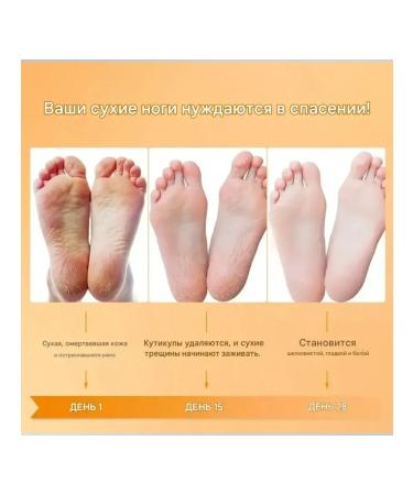 MaxWish 09 Chinese miracle cream for cracked heels 1 pcs - Buy Online on GoSupps.com