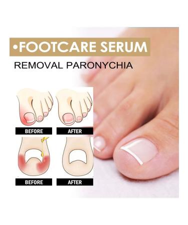 Eelhoe elimination of panarization of serum to care - Buy Online on GoSupps.com