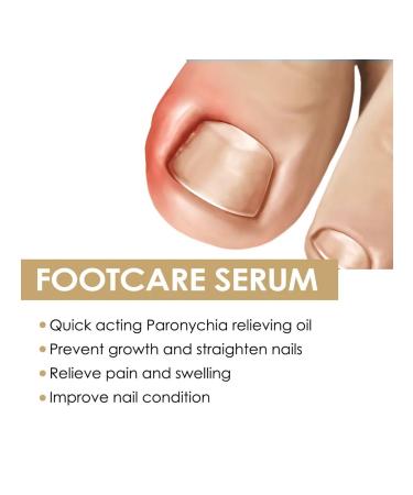 Eelhoe elimination of panarization of serum to care - Buy Online on GoSupps.com