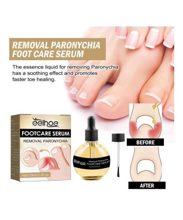 Eelhoe elimination of panarization of serum to care - Buy Online on GoSupps.com