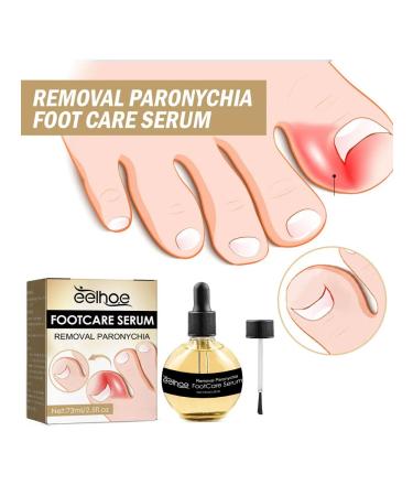 Eelhoe elimination of panarization of serum to care - Buy Online on GoSupps.com