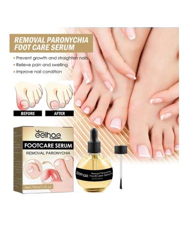 Eelhoe elimination of panarization of serum to care - Buy Online on GoSupps.com