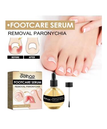 Eelhoe elimination of panarization of serum to care - Buy Online on GoSupps.com