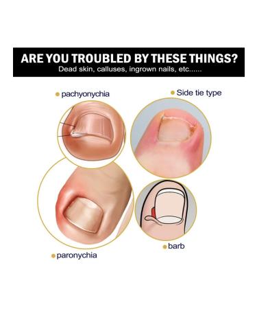 Eelhoe elimination of panarization of serum to care - Buy Online on GoSupps.com