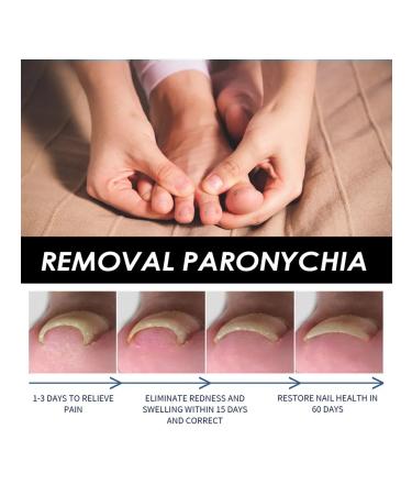 Eelhoe elimination of panarization of serum to care - Buy Online on GoSupps.com