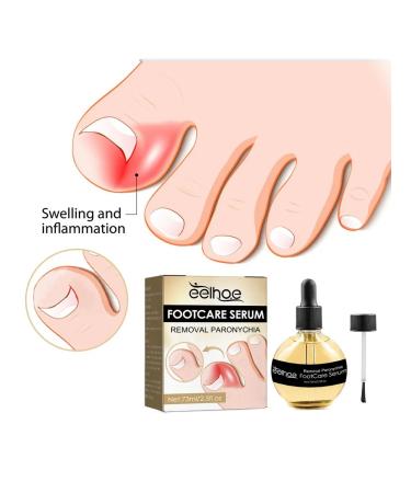 Eelhoe elimination of panarization of serum to care - Buy Online on GoSupps.com